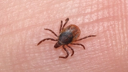 Sask. saw 'off the charts' reports of tick able to carry Lyme disease