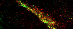 Surprise Discovery About Dopamine May Help Explain Parkinson's